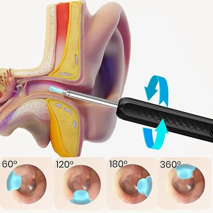 Professional Wireless Ear Wax Removal Tool with HD Endoscope Camera and LED Light